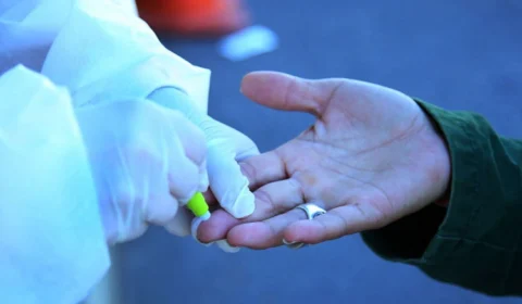 Amazonas registra 32 novos casos de Covid-19 nas últimas 24h