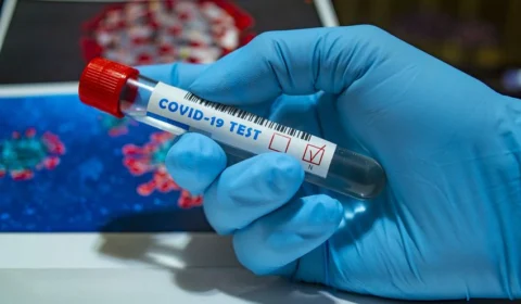 Em 24h, Amazonas registrou 550 novos casos de Covid-19