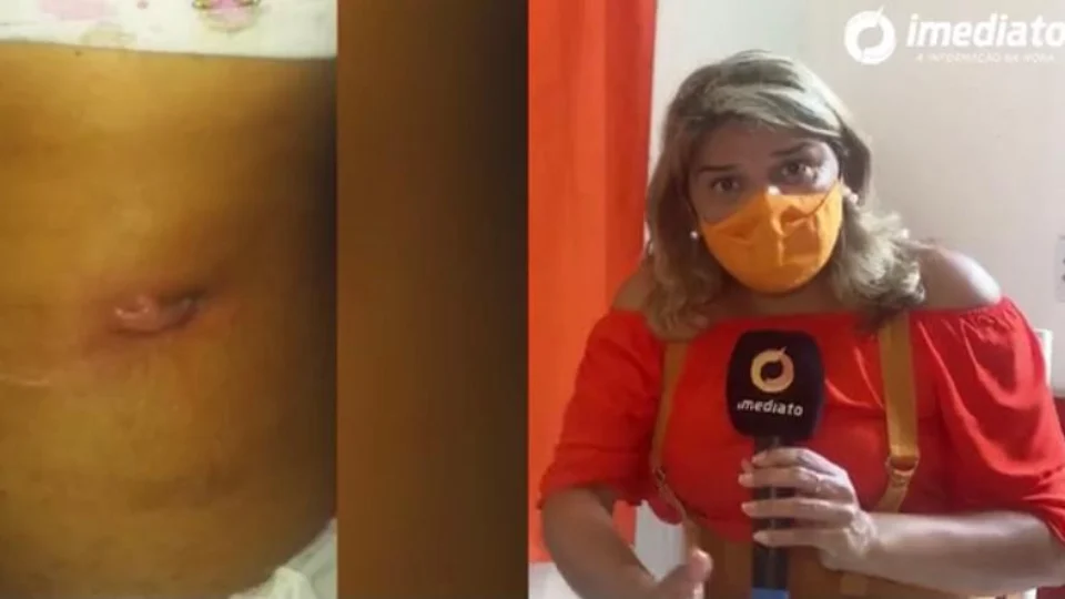 Mulher desesperada pede ajuda de médico após cirurgia infeccionar; Veja detalhes