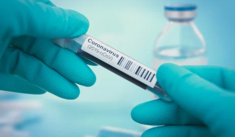 Covid-19: Boletim diário informa 471 novos casos da doença no Amazonas, nas últimas 24h