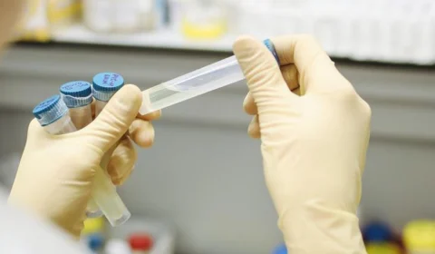 Boletim Covid-19 desta sexta-feira (11) informa 716 novos casos da doença nas últimas 24h