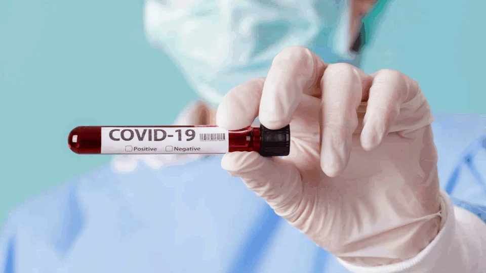 Boletim diário da FVS-AM informa o registro de 393 novos casos de Covid-19 nas últimas 24h