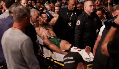 Conor McGregor passa por cirurgia após fratura na tíbia durante o UFC 264; Veja vídeo