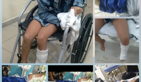 Família promove feijoada em prol de crianças atropeladas na zona Norte de Manaus