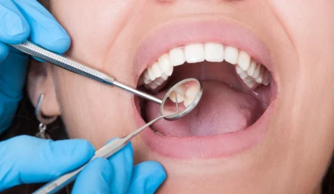 Cuidados com a saúde bucal precisam ser redobrados para quem já teve covid-19