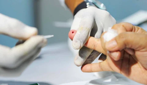 Unimed Manaus promove palestra e atualiza vacinação contra hepatites virais nesta quarta (28)