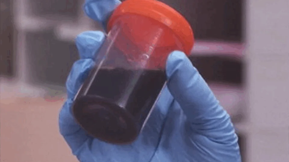 Sobe para 44 o número de casos de rabdomiólise no Amazonas; Pacientes são de 6 municípios