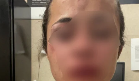 “Ele quase me matou nos Estados Unidos”; diz tatuadora espancada pelo namorado em Las Vegas; Veja vídeo