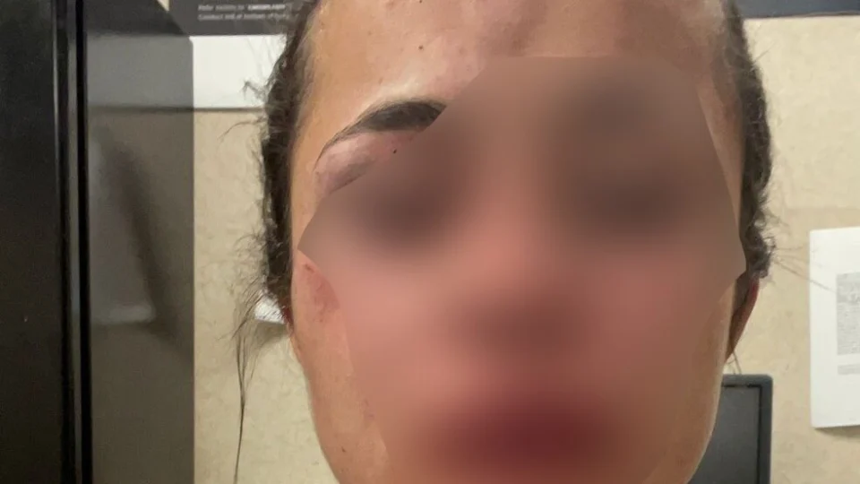 “Ele quase me matou nos Estados Unidos”; diz tatuadora espancada pelo namorado em Las Vegas; Veja vídeo