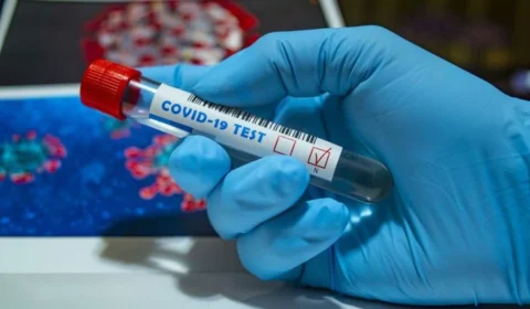 Amazonas registra 1.608 novos casos de covid-19 nesta segunda-feira (31)