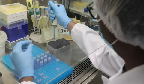 Amazonas tem 49 novos casos de Covid-19 e 1 óbito pela doença nas últimas 24h