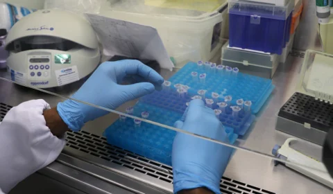 Amazonas tem novos 64 casos e 1 óbito por Covid-19 nas últimas 24h, informa FVS-RCP