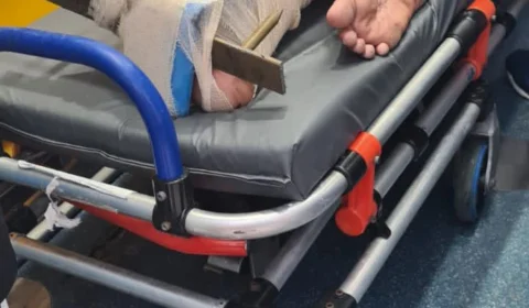 Lança atravessa pé de menino ao tentar pular muro de igreja; Veja vídeo!