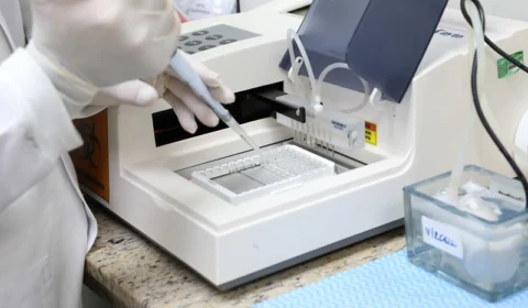 Amazonas não tem ocorrência de óbito pela Covid-19 nas últimas 24h, aponta boletim da FVS-RCP