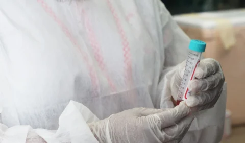 Nesta sexta (19) mais 79 casos de Covid-19 são registrados no Amazonas