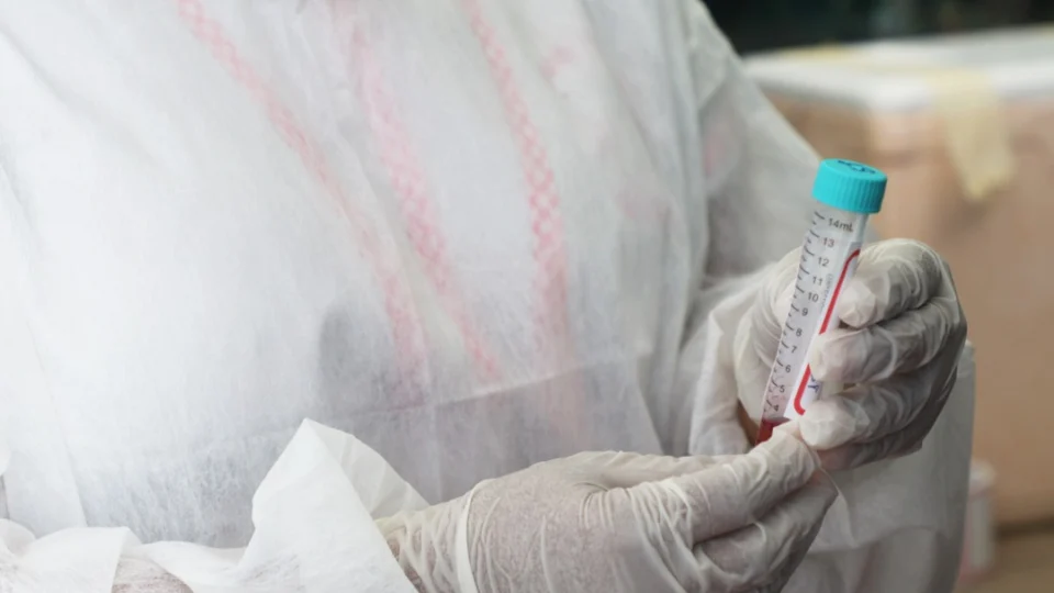 Nesta sexta (19) mais 79 casos de Covid-19 são registrados no Amazonas