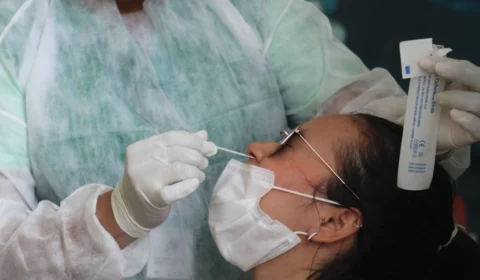 Amazonas tem 141 novos casos de Covid e 5 suspeitos de varíola dos macacos