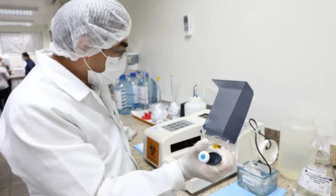 Amazonas registra 140 novos casos por Covid-19 nas últimas 24 horas