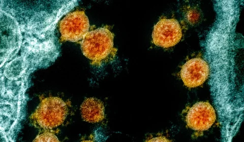 Rio Grande do Sul confirma caso de infecção pela variante Ômicron