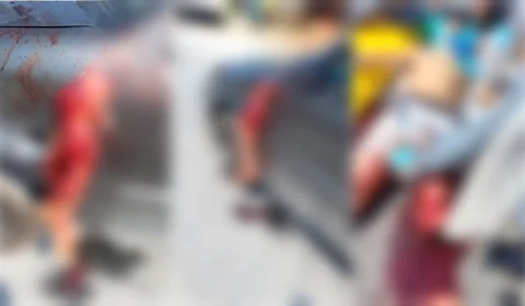 ATENÇÃO – Cenas fortes | motoqueiro colide com carro e tem a perna arrancada