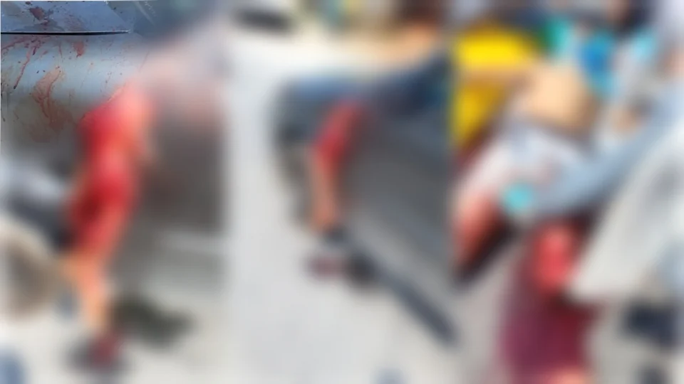 ATENÇÃO – Cenas fortes | motoqueiro colide com carro e tem a perna arrancada