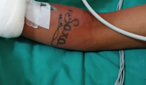 HPS João Lúcio procura por familiares de paciente acidentado em Manaus