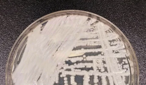 Anvisa confirma segundo caso de Candida auris em Pernambuco