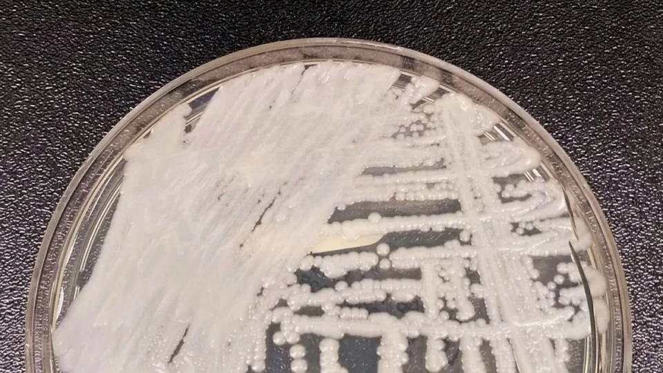 Anvisa confirma segundo caso de Candida auris em Pernambuco