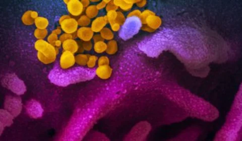 Covid-19: estudo aponta aumento de bactérias resistentes em UTIs