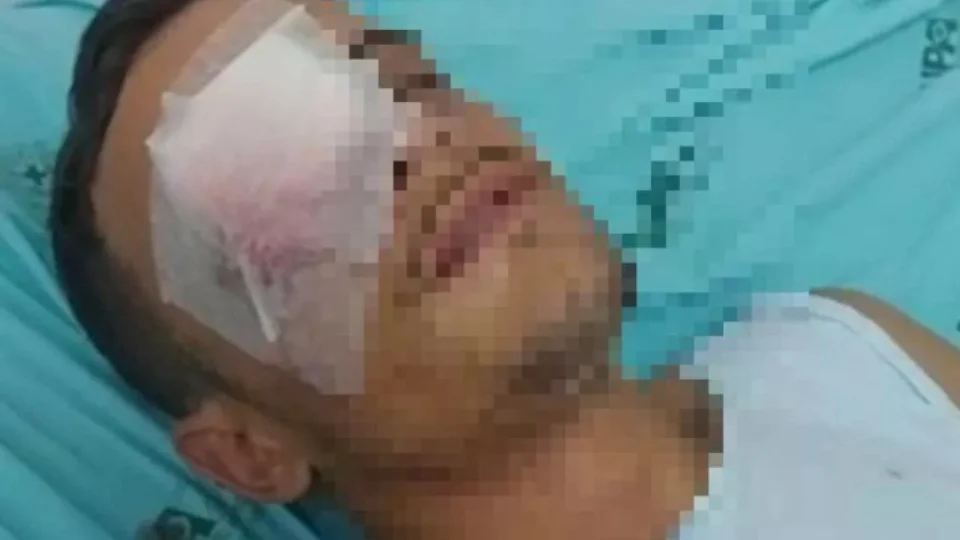 Após ser agredida com um soco, jovem fura o olho do namorado