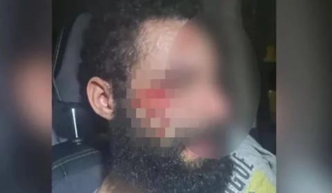 VEJA VÍDEO! Médica corta a parte íntima do marido