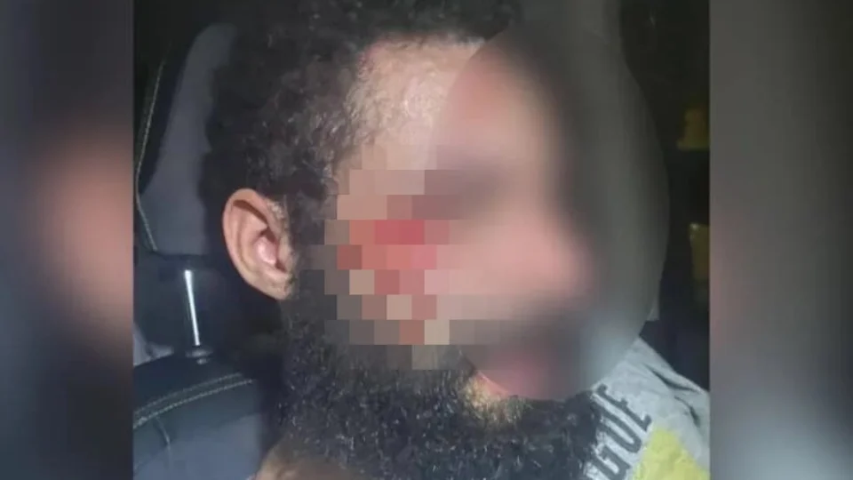 VEJA VÍDEO! Médica corta a parte íntima do marido