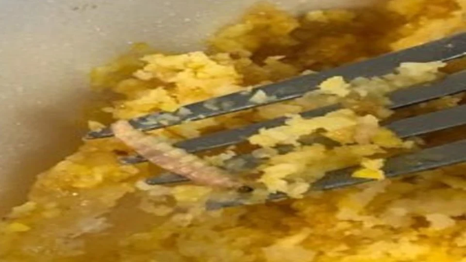 Aluno encontra larvas em comida servida no restaurante universitário