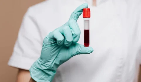 Cresce demanda por serviços de saúde em domicílio em Manaus