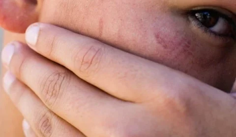 “Ele é um monstro”, diz garoto espancado por homem após assobio; veja vídeo