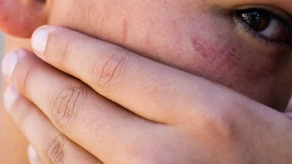 “Ele é um monstro”, diz garoto espancado por homem após assobio; veja vídeo