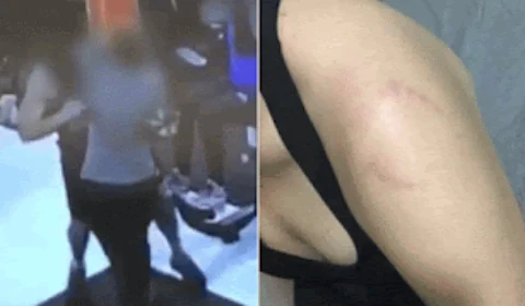 ‘Ele ficava rindo’, diz jovem que foi mordida por homem em 1º dia na academia