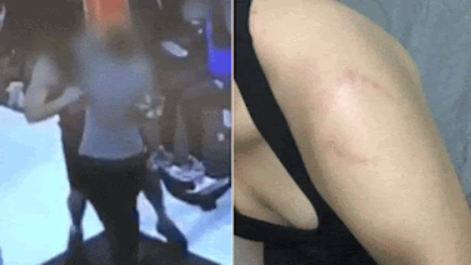 ‘Ele ficava rindo’, diz jovem que foi mordida por homem em 1º dia na academia