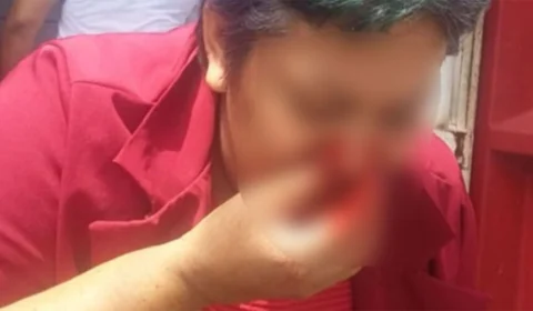 CENAS FORTES: pai agride educadora com soco no rosto