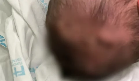 Bebê tem traumatismo craniano após queda na maternidade