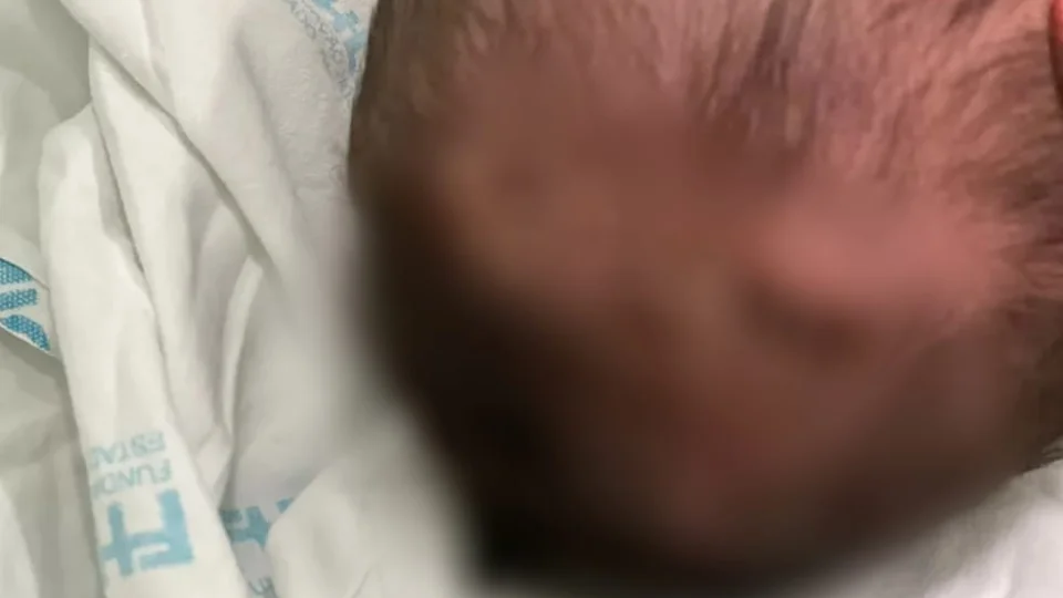 Bebê tem traumatismo craniano após queda na maternidade