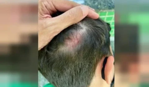 “Vontade de dar facada”, alunos de escola particular em grupo no whatsApp