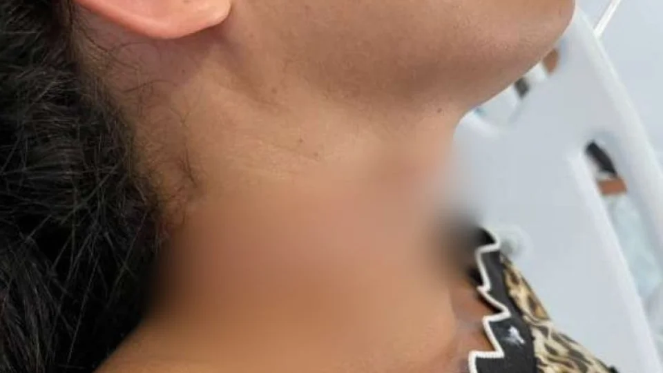 Jovem fica ferida no pescoço após fio romper em avenida