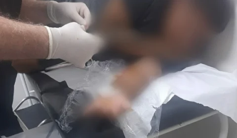 Jovem é baleado e relata ter sido vítima de roubo na zona Oeste de Manaus