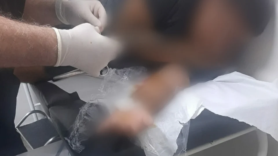 Jovem é baleado e relata ter sido vítima de roubo na zona Oeste de Manaus