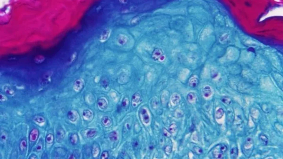 Varíola dos macacos: amostras de sêmen detectam DNA do vírus