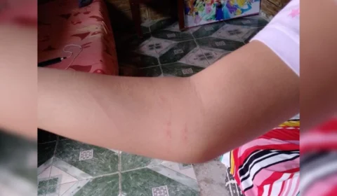 VÍDEO: Aluna com Síndrome de Down é agredida em escola