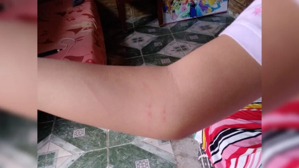 VÍDEO: Aluna com Síndrome de Down é agredida em escola