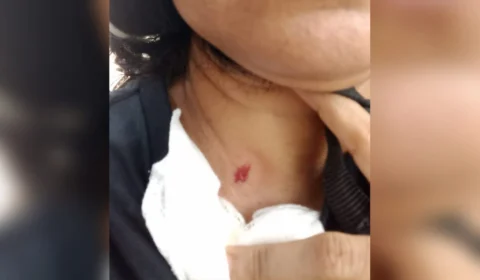 VEJA VÍDEO: Mulher é atingida de raspão durante tentativa de homicídio
