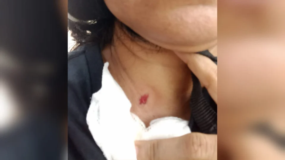 VEJA VÍDEO: Mulher é atingida de raspão durante tentativa de homicídio